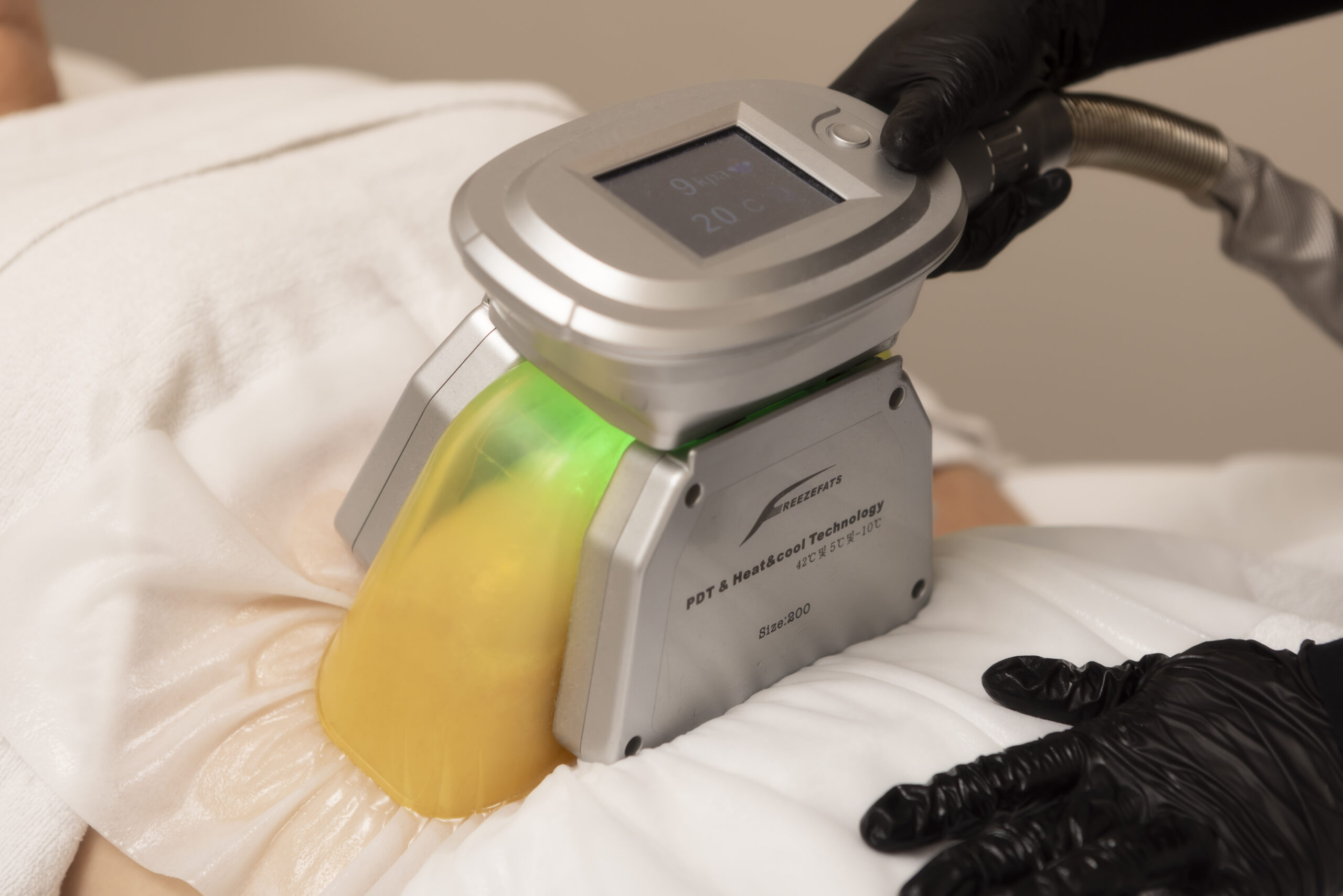 Figuurcorrectie met cryolipolyse in Barendrecht bij SKIN INSTITUTE