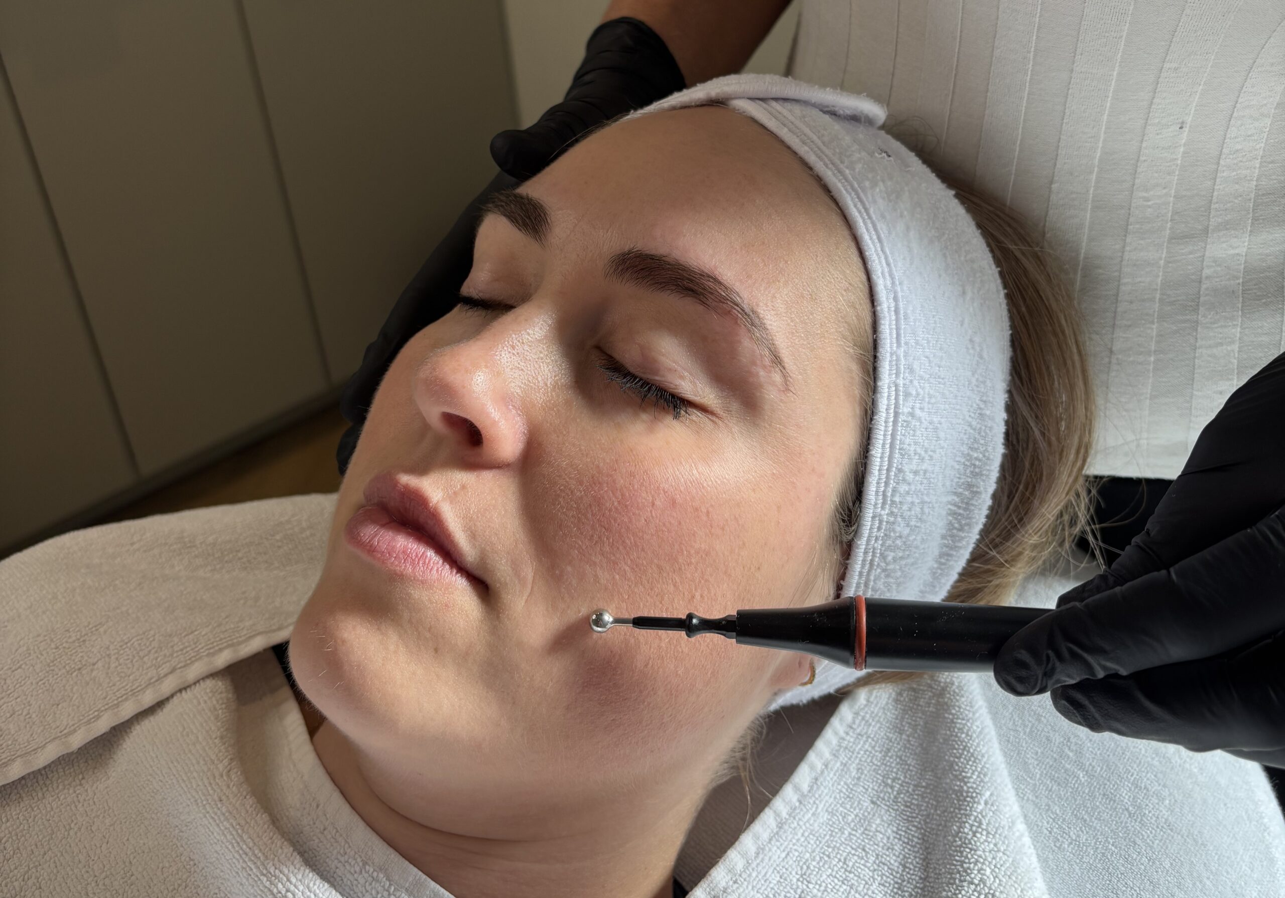 TeslaMed-behandeling bij SKIN INSTITUTE Barendrecht