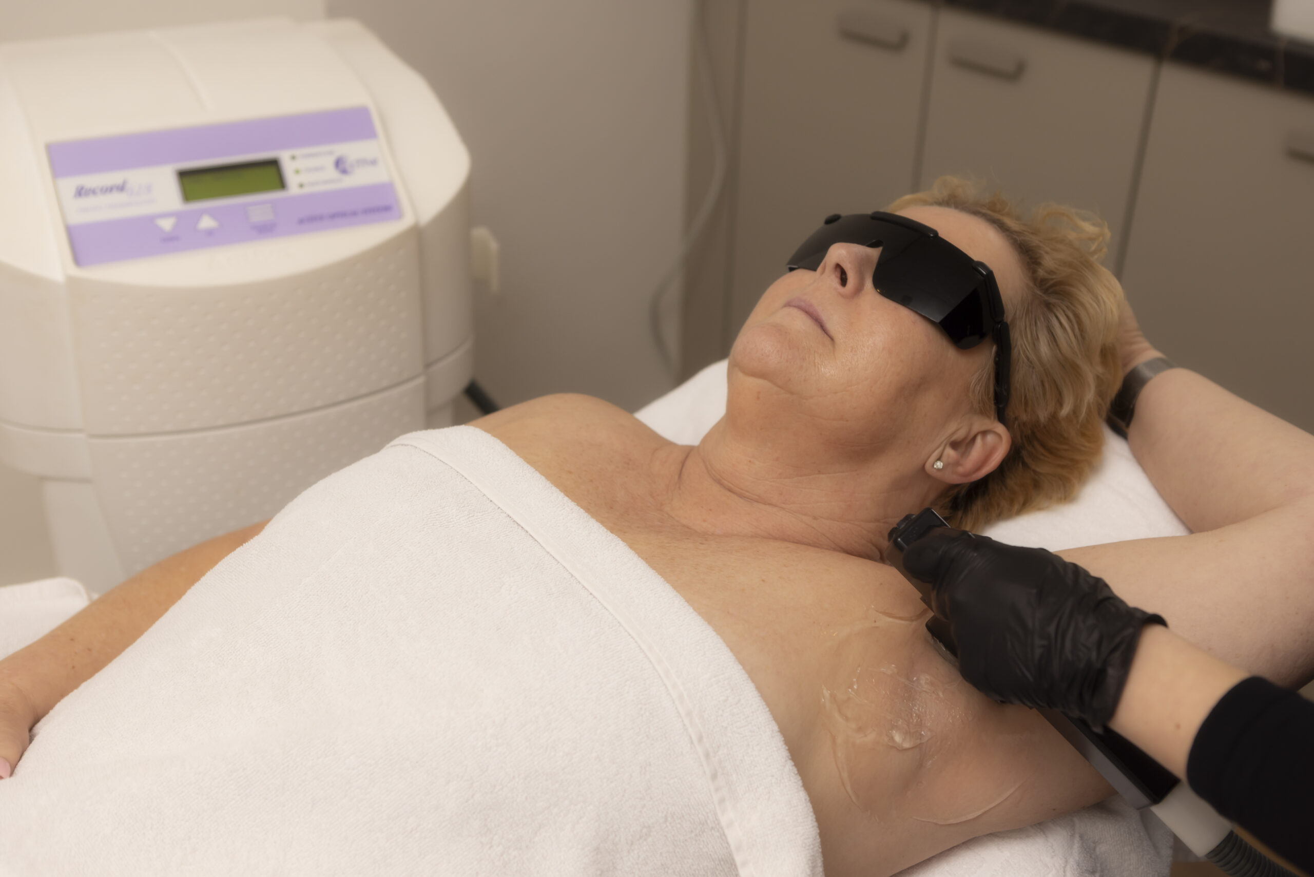 Definitieve ontharing in Barendrecht met H-IPL bij SKIN INSTITUTE